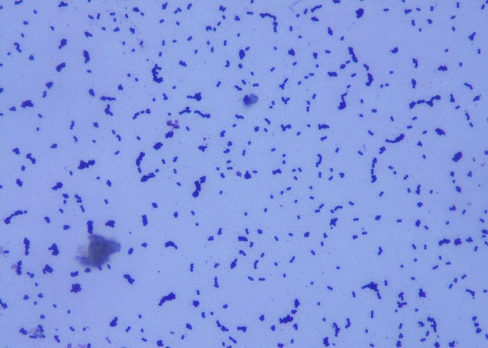 Молочнокислые бактерии – что это? Молочнокислые бактерии – что это?