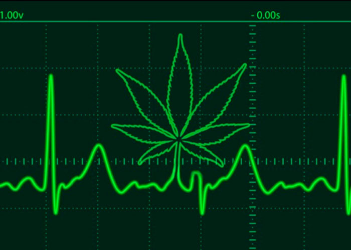 Сердечно-сосудистые проблемы Сердечно-сосудистые проблемы
